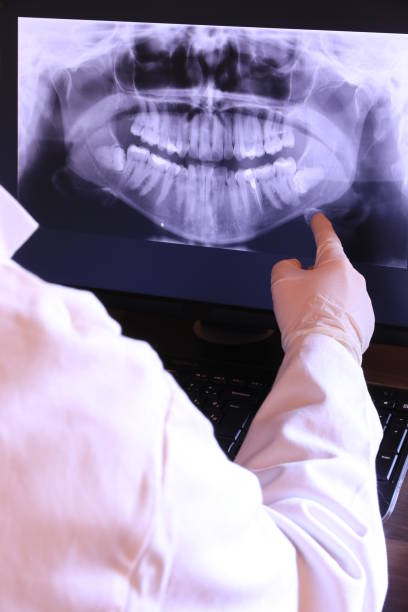 Best Emergency Dental Care for Abscessed Tooth in Dawsonville, GA