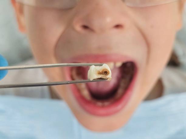 Best Emergency Cosmetic Dentistry in Dawsonville, GA